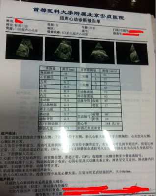 视频彩铃心动会员收费吗,胎儿超声心动多少钱 第3张 视频彩铃心动会员收费吗,胎儿超声心动多少钱 第3张