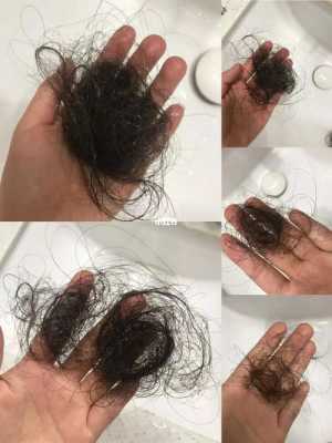 孕期脱发严重(产后脱发严重该怎么办) 第3张 孕期脱发严重(产后脱发严重该怎么办) 第3张