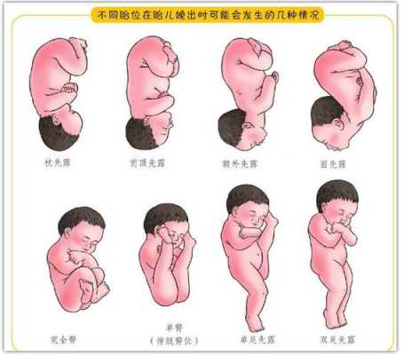 胎儿仰面位图片（如何练习小孩翻身再翻过来）  第2张