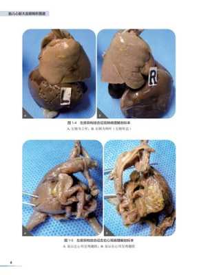 胎儿血管畸形原因(胎儿畸形是什么原因造成的) 第2张 胎儿血管畸形原因(胎儿畸形是什么原因造成的) 第2张