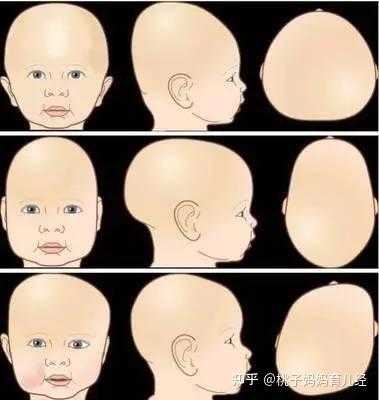 宝宝睡觉平躺头侧着睡会不会不好呢?怎么样才能睡得好看,胎儿侧着身子能看出男女吗 第2张 宝宝睡觉平躺头侧着睡会不会不好呢?怎么样才能睡得好看,胎儿侧着身子能看出男女吗 第2张