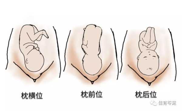 胎儿暂头位(胎儿暂头位是什么意思) 第3张 胎儿暂头位(胎儿暂头位是什么意思) 第3张