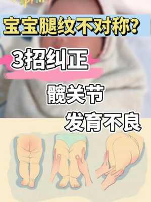 10个月宝宝大腿纹路不对称这正常不,胎儿腿直臀位什么意思 第1张 10个月宝宝大腿纹路不对称这正常不,胎儿腿直臀位什么意思 第1张