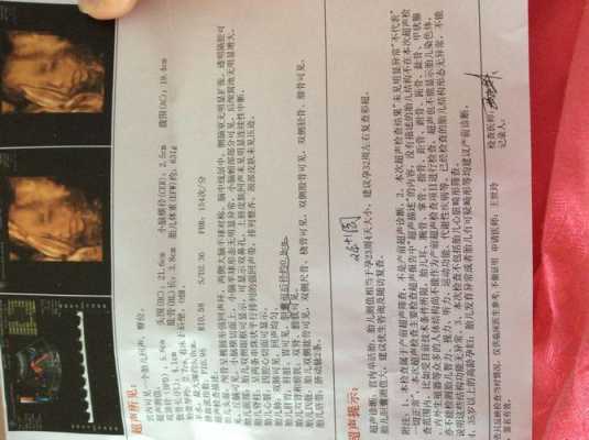 怀孕33周打彩超时胎儿的胆囊显示不清是怎么回事,为什么,胎儿胆囊充盈差是什么原因 第2张 怀孕33周打彩超时胎儿的胆囊显示不清是怎么回事,为什么,胎儿胆囊充盈差是什么原因 第2张