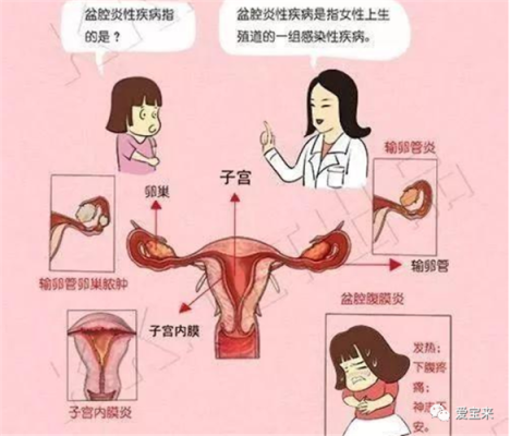 孕期子宫压痛(孕期子宫压痛怎么办) 第2张 孕期子宫压痛(孕期子宫压痛怎么办) 第2张