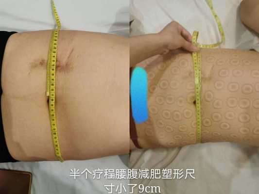 孕期塑形(孕期塑形好还是产后塑形) 第1张 孕期塑形(孕期塑形好还是产后塑形) 第1张