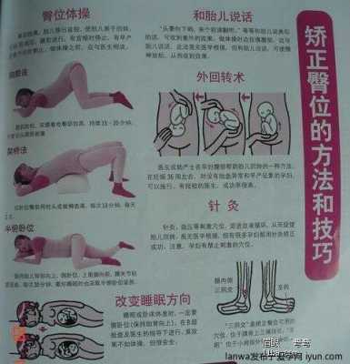 胎儿一直臀位什么原因,要怎么可以调整过来,胎儿臀位是啥意思 第3张 胎儿一直臀位什么原因,要怎么可以调整过来,胎儿臀位是啥意思 第3张