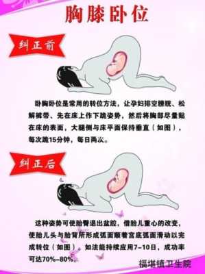 胎儿一直臀位什么原因,要怎么可以调整过来,胎儿臀位是啥意思 第2张 胎儿一直臀位什么原因,要怎么可以调整过来,胎儿臀位是啥意思 第2张