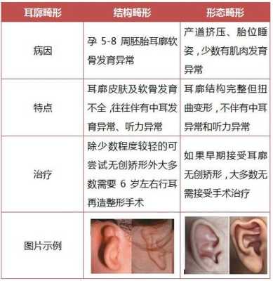 胎儿耳朵畸形的原因（胎儿耳朵畸形的原因是怎样造成的）  第2张