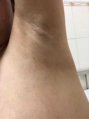 孕期汗毛变长(怀孕后身上汗毛变多是不是正常的啊?不仅仅是变得多了还很黑的呢) 第2张 孕期汗毛变长(怀孕后身上汗毛变多是不是正常的啊?不仅仅是变得多了还很黑的呢) 第2张