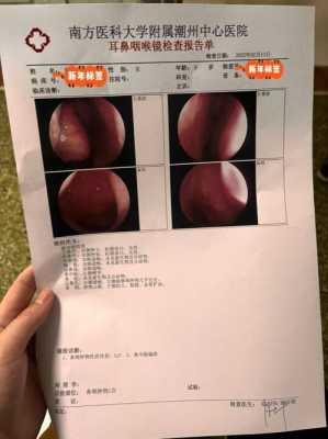 孕妇鼻屎多怎么回事,孕期鼻屎多怎么回事,而且还有血丝 第2张 孕妇鼻屎多怎么回事,孕期鼻屎多怎么回事,而且还有血丝 第2张