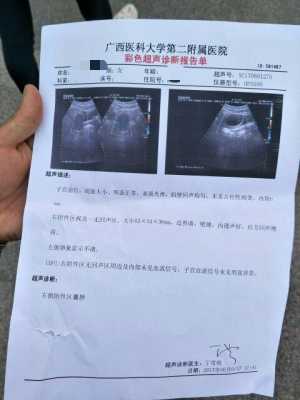 孕期附件疼（怀孕了右侧附件区囊肿怎么办）  第2张