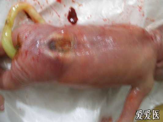 胎儿脑积水孕妇症状(胎儿脑积水孕妇症状) 第2张 胎儿脑积水孕妇症状(胎儿脑积水孕妇症状) 第2张