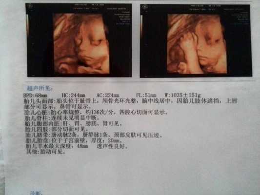 孕27周胎儿在什么位置?怎么知道,怀孕27周胎儿彩超图片 第2张 孕27周胎儿在什么位置?怎么知道,怀孕27周胎儿彩超图片 第2张