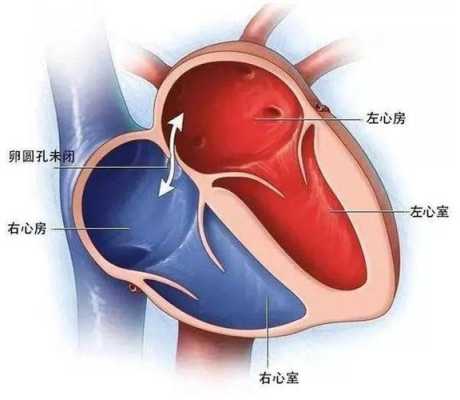 男胎儿有卵圆孔吗(男胎儿有卵圆孔吗图片) 第3张 男胎儿有卵圆孔吗(男胎儿有卵圆孔吗图片) 第3张