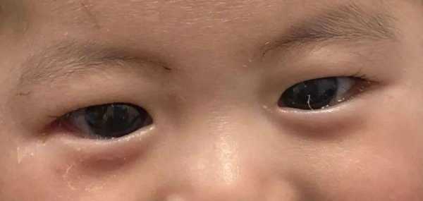 胎儿几周出生是正常的(新生儿眼睛大小多久可以看出来) 第2张 胎儿几周出生是正常的(新生儿眼睛大小多久可以看出来) 第2张