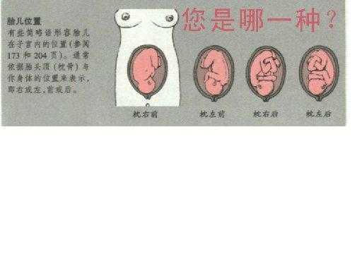 三十二周胎儿发育情况(孕32周胎位LOT是什么意思?可以给孕妇吃什么东西) 第2张 三十二周胎儿发育情况(孕32周胎位LOT是什么意思?可以给孕妇吃什么东西) 第2张