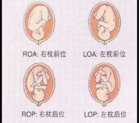 三十二周胎儿发育情况(孕32周胎位LOT是什么意思?可以给孕妇吃什么东西) 第1张 三十二周胎儿发育情况(孕32周胎位LOT是什么意思?可以给孕妇吃什么东西) 第1张