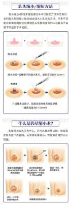 母乳喂奶乳头破皮流血了怎么办,孕期乳晕破皮流水抹乳汁有用吗 第1张 母乳喂奶乳头破皮流血了怎么办,孕期乳晕破皮流水抹乳汁有用吗 第1张