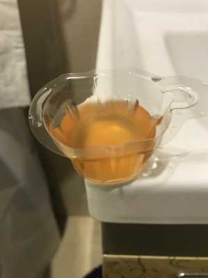 孕期尿液发红(孕期尿液发红褐色怎么回事) 第3张 孕期尿液发红(孕期尿液发红褐色怎么回事) 第3张
