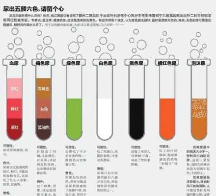 孕期尿液发红(孕期尿液发红褐色怎么回事) 第2张 孕期尿液发红(孕期尿液发红褐色怎么回事) 第2张