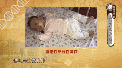 癫痫病人可以要小孩吗, 第1张 癫痫病人可以要小孩吗, 第1张