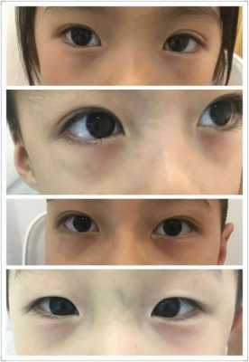 8个月宝宝黑眼圈是怎麽回事,8个月胎儿样子图片 第1张 8个月宝宝黑眼圈是怎麽回事,8个月胎儿样子图片 第1张