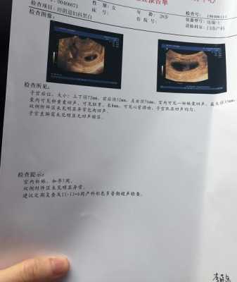胎儿头圆还是椭圆好(胎儿头圆还是椭圆好看) 第2张 胎儿头圆还是椭圆好(胎儿头圆还是椭圆好看) 第2张