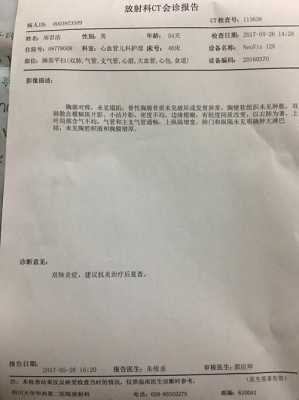 出生几天婴儿照CT有什么副作用吗,孕妇拍ct对胎儿有什么影响  第2张