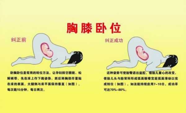 孕期胎儿体位(孕期胎儿体位不好) 第1张 孕期胎儿体位(孕期胎儿体位不好) 第1张
