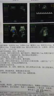 冷热双泡什么意思,胎儿双泡征是什么原因 第1张 冷热双泡什么意思,胎儿双泡征是什么原因 第1张