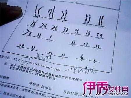胎儿染色体是检查什么(胎儿染色体是检查什么的?) 第1张 胎儿染色体是检查什么(胎儿染色体是检查什么的?) 第1张
