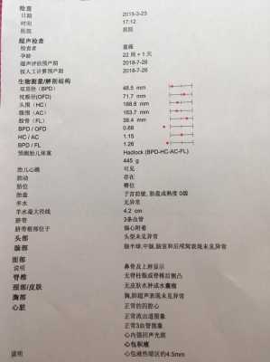 胎儿心包腔积液正常值(心包少量积液是怎么回事) 第1张 胎儿心包腔积液正常值(心包少量积液是怎么回事) 第1张