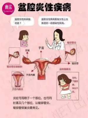 盆腔炎会影响胎儿吗(盆腔炎会影响胎儿吗) 第1张 盆腔炎会影响胎儿吗(盆腔炎会影响胎儿吗) 第1张
