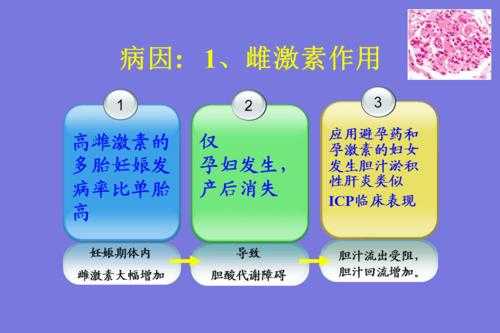 妊娠期肝内胆汁淤积症是什么,怀孕胆汁淤积对胎儿有什么影响 第1张 妊娠期肝内胆汁淤积症是什么,怀孕胆汁淤积对胎儿有什么影响 第1张