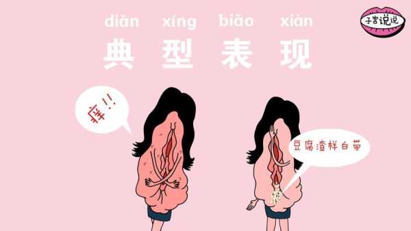 孕期阴道干燥  第1张