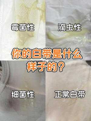 白带异常会影响受孕吗, 第3张 白带异常会影响受孕吗, 第3张