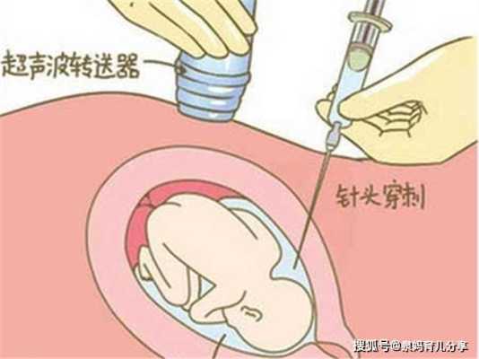 羊穿对胎儿有影响吗(羊穿对胎儿有影响吗?) 第1张 羊穿对胎儿有影响吗(羊穿对胎儿有影响吗?) 第1张