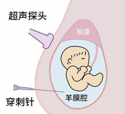 羊穿对胎儿有影响吗(羊穿对胎儿有影响吗?) 第2张 羊穿对胎儿有影响吗(羊穿对胎儿有影响吗?) 第2张