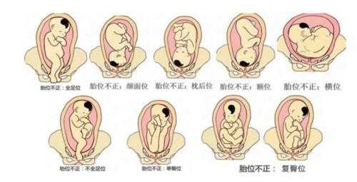 胎儿在肚子的左边还是右边(胎动在右边吗) 第1张 胎儿在肚子的左边还是右边(胎动在右边吗) 第1张