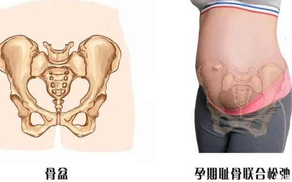 孕期骨盆检查(孕期骨盆检查怎么检查) 第2张 孕期骨盆检查(孕期骨盆检查怎么检查) 第2张