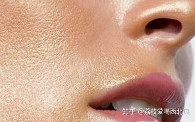适合油皮孕妇用的防晒,孕期脸上出油怀男孩还是女孩  第2张