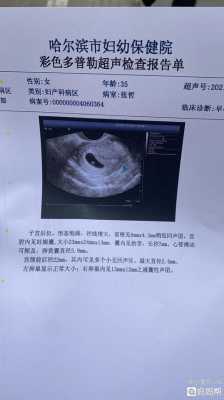几个月长胎心和胎芽,怎么让胎儿长胎心胎芽呢  第1张