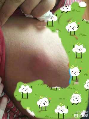 孕期乳房白点(经常堵奶。要怎么办,里面白点溶挤出来以后过几天又有白点) 第2张 孕期乳房白点(经常堵奶。要怎么办,里面白点溶挤出来以后过几天又有白点) 第2张