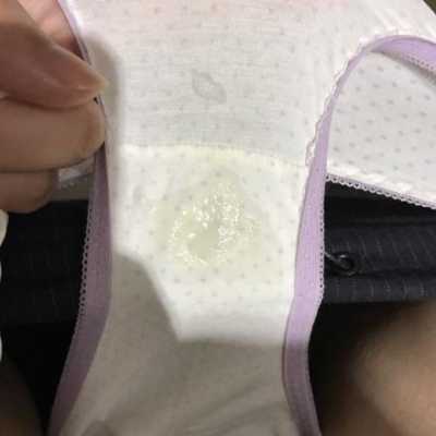 为什么怀孕了初期没有白带呢,出现这种情况算不算正常的, 第2张 为什么怀孕了初期没有白带呢,出现这种情况算不算正常的, 第2张