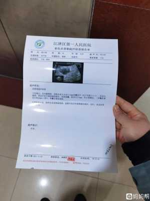 宫腔有积血对胎儿有影响吗,怀孕初期出血对胎儿有影响吗? 第2张 宫腔有积血对胎儿有影响吗,怀孕初期出血对胎儿有影响吗? 第2张