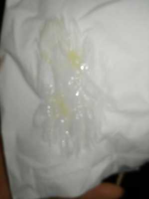 孕期鼻涕多(孕期鼻涕多是怎么回事) 第2张 孕期鼻涕多(孕期鼻涕多是怎么回事) 第2张