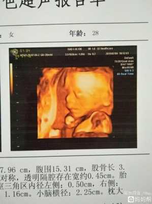 孕21周可以做四维吗,21周胎儿四维彩超图片 第2张 孕21周可以做四维吗,21周胎儿四维彩超图片 第2张