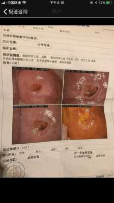 孕期宫颈活检(孕期宫颈活检有危险吗) 第2张 孕期宫颈活检(孕期宫颈活检有危险吗) 第2张