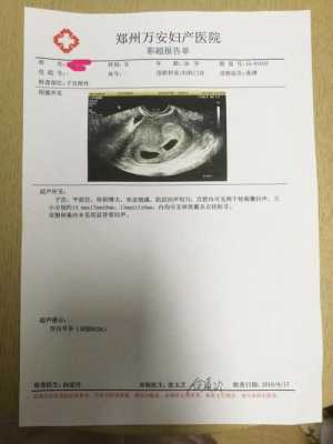 双胞胎的身份证号有什么区别,双胞胎四个月胎儿图片 第1张 双胞胎的身份证号有什么区别,双胞胎四个月胎儿图片 第1张